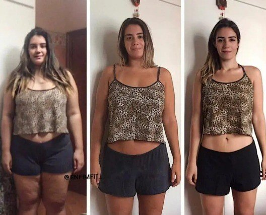 Antes e Depois Karoline